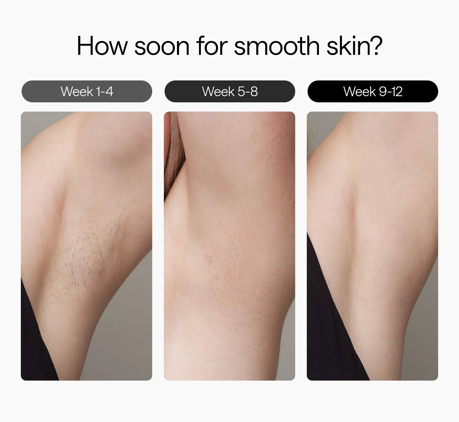 Zařízení na odstraňování chloupků ledovým teplem Sapphire Ice IPL